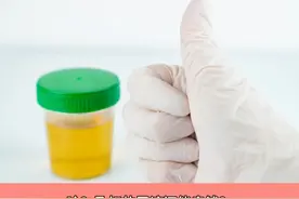 孕妇的尿液真的可以卖钱？ #孕妇尿液 含有#HCG 也就是#人体绒毛膜促性腺激素 主要可以用于验孕试纸的生产，也可能用于提取成分制作保胎药和排卵激素。