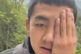 男子被蜜蜂蛰后判若两人 网友：人瘦了才是真实的颜值（来源：@ACE. ）#蜜蜂蛰 #判若两人 #惊不惊喜意不意外 #没想到吧我也没想到 #哎呀妈呀视频封面