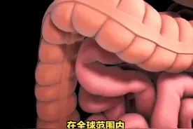 结直肠癌：年轻化趋势与科学防治 结直肠癌视频封面