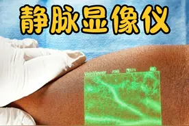 不可思议的静脉显像仪，光线打在皮肤上，竟然将血管照了出来！ #黑科技 #科技改变生活 #静脉显像仪 #涨知识 #奇闻趣事视频封面