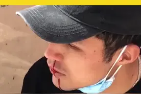 4月5日，新疆乌鲁木齐，男生吃完饭中暑，看到长腿美女突然飙出鼻血，网友：这下解释不清了视频封面