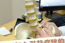 我们腰突压迫神经是怎么引起症状的呢，今天我来告诉你原理#骨科  #脊柱健康  #脊柱医生李谦  #腰疼 #腰椎间盘突出视频封面