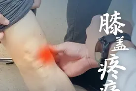 老年人膝盖疼，不是必须手术，医生：保守治疗缓解症状延缓退化 #硬核健康科普行动 #年度健康知识干货大赏 #膝盖疼 #膝关节疼痛 #保膝医生贾俊秀 @脊柱医生时宗庭