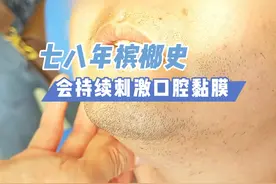 七八年槟榔史累积，持续刺激口腔黏膜，可能会出现哪些情况#医学科普 #医者仁心 #秦兴军 #槟榔的危害 #槟榔致癌视频封面