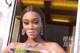 维密秀首位白癜风超模要嫁人了，新郎是NBA球星库兹马 #白癜风超模 #维密秀 #nba视频封面