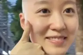 四川成都，25岁女生掉发严重索性剃光头：摆脱发量焦虑后比之前更快乐。#四川成都 #剃光头 #发量焦虑 #快乐就这么简单视频封面