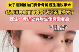 女子撞到推拉门鼻骨骨折 医生建议手术， 结果消肿后变高鼻梁 美出新高度，医生：骨折处有增生使鼻梁变高视频封面