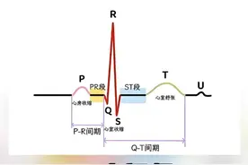一个视频教会你看心电图 #一种看似偷懒其实健康的行为  #心梗  #冠心病  #在抖音pick你的健康搭子  #解锁春日健康清单视频封面