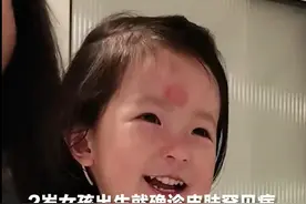 2岁女孩出生就确诊皮肤罕见病 皮肤一碰就碎 需24小时戴手套 父母：可能“粮食”不够，但敷料管够视频封面