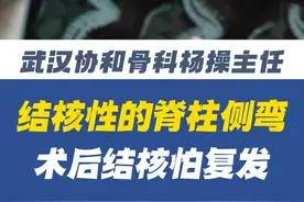 结核性的脊柱侧弯,手术以后怕结核复发! #结核病 #脊柱侧弯 #脊柱后凸 #医学科普 #硬核健康科普行动视频封面