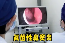 真菌性鼻窦炎术后2个月，没有病变残留，术后恢复很好 #硬核健康科普行动  #2025健康许愿池 #真菌性鼻窦炎 #鼻窦炎手术 #流鼻涕视频封面
