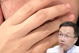 开了内眼角，顺便治了“斗鸡眼” #让我们一起变美 #双眼皮 #眼部皮肤有多薄 #变美 #干货分享视频封面