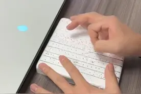 千万别眨眼，男护士长苦练飞针采血 技术一流，初衷为降低病人痛感#飞针采血 #护士长 #厉害了 来源@飞针采血王洋视频封面