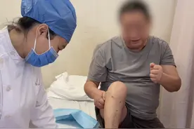 意外砸脚，仅仅4天，伤口感染渗出液体 #糖尿病足 不愈合，两次清创+植皮#保肢视频封面