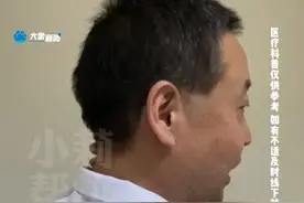 低头看手机，坐太久，头晕头疼，医生教你按藏在身上的“止痛穴” ，网友：收藏了！原来这么简单有效。视频封面
