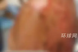 男生疑被同学用11盆开水烫伤，当地教育局通报：2名中学生因欺凌同学被刑拘视频封面