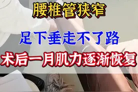 #腰椎管狭窄 #腰椎间盘突出 足下垂走不了路，大小便困难，术后一个月，逐渐恢复正常生活#科普视频封面