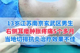 耳瘘平时痒痒的，有臭味这种情况有分泌物只是少量而已#耳前瘘管 #抖出健康知识宝藏  #武汉陈金辉视频封面