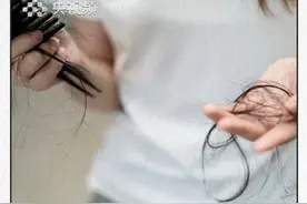 掉发≠脱发！教你一招分清楚！ （央视频号：#央视财经中国好医生  ）