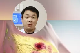 乳腺癌的复发有两个小高峰乳腺癌病人 一定要看完这个视频 #乳腺癌   #天下无癌   #乳腺疾病视频封面