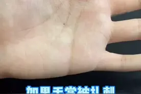 #手上的刺怎么去除小妙招 #科普 #辟谣 #dou来说健康 #皮肤 #健康 视频封面