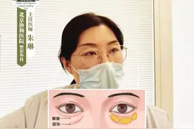 眼袋泪沟和细纹，不想动刀可以试试填充！ #硬核健康科普dou来说 #熊猫针 #嗨体 #眼袋 #泪沟视频封面