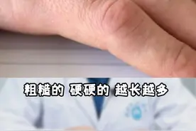 手上长了黄豆大小的硬疙瘩，这样处理是比较快的#健康 #科普#好东西一起分享 视频封面