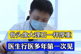 发病率为25万分之1的罕见病：石骨症。 #小儿神经外科赵阳 #小儿神外赵阳医生 #罕见病 #儿科 #门诊案例视频封面
