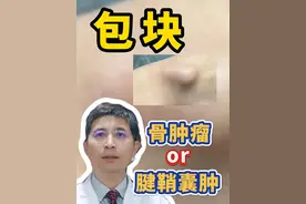 手腕上有包块，到底是腱鞘囊肿还是骨肿瘤？ #硬核健康科普行动  #医疗健康创作训练营 #腱鞘囊肿 #骨肿瘤 #包块视频封面