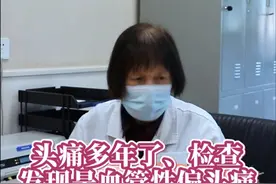 头痛多年了、检查发现是血管性偏头痛 #门诊故事 #门诊日常 #偏头痛视频封面