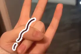 女子手指一弯就抖个不停，伸开却没问题 这是咋回事儿？女生：怀疑跟熬夜和营养不良有关#手抖  #这是什么情况啊 #熬夜 （来源：@黄囝囝 ）视频封面