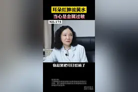 有耳洞的美女注意了，耳朵红肿流黄水，小心是金属感染！#耳钉 #过敏 #皮肤 #健康 #情侣 #女性 视频封面