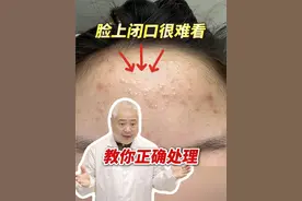 脸上长闭口，密密麻麻一片很难看，三甲医生教你正确处理！ #涨知识 #医学科普 #抖出健康知识宝藏   #闭口 #颜值视频封面