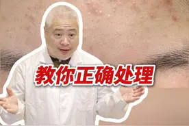 脸上长闭口，密密麻麻一片很难看，三甲医生教你正确处理！ #涨知识 #医学科普 #抖出健康知识宝藏   #闭口 #颜值视频封面