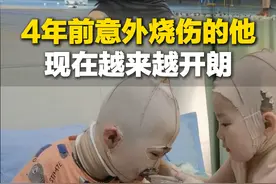 3月28日，山东济南。男孩4年前意外烧伤，坚持打羽毛球一年多，越来越开朗。孩子妈妈：不好的已经过去 现在很知足@小轩百货店 #励志 #生活不会辜负每一个努力的人视频封面