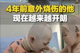 3月28日，山东济南。男孩4年前意外烧伤，坚持打羽毛球一年多，越来越开朗。孩子妈妈：不好的已经过去 现在很知足@小轩百货店 #励志 #生活不会辜负每一个努力的人视频封面