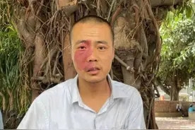 深圳寻亲：青年男子被救助，系流浪人员，右脸有红色胎记，疑似潮州人图片
