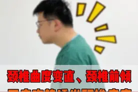 颈椎前倾，颈椎曲度变直怎么办？一招教你缓解！  #抖出健康知识宝藏 #颈椎曲度变直 #颈椎反弓 #颈椎病 #颈椎视频封面