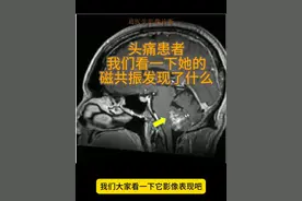 头痛患者磁共振检查发现占位20241224 发现问题，先不要慌
这是一个通过影像 好好看病的视频
通过分析介绍不同疾病影像特点，畅聊影像医生工作过程与实际工作中遇到的问题，建立与患者之间的联系，从而服务患者，为患者答疑解惑。
同时，通过CT磁共振影像检查手段，交流学习疾病诊断思路，不断深入探索，精益求精。#磁共振 #头疼 #脑肿瘤 #误诊 #硬核健康科普行动视频封面