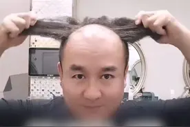 男子给自己设计发型，稀疏头发一秒变浓密，本人回应：可以抗八级大风！#发型 #头发 #脱发 （来源：Vista看天下@方泳精致烫染  ）视频封面