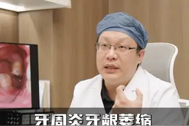 牙周炎牙龈萎缩造成的黑三角该怎么处理？视频封面