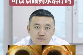 翼状胬肉可以点眼药水治疗吗 #翼状胬肉  #眼部健康视频封面