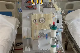 一分钟让您了解如何做双重血浆置换 #医学科普 #医疗设备视频封面