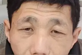 保定市寻亲：青年男子被救助，自述叫马小虎，高1米65，穿黑色上衣图片