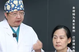 主任打假“无痕拉皮”，如何减轻拉皮后痕迹呢？ #医学科普 #拉皮手术 #去疤痕 #面部提升视频封面