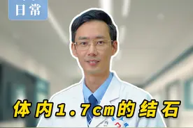 体内1.7cm的结石，患者：能不做手术嘛？ #门诊日常 #抖出健康知识宝藏  #肾结石 #微创手术 #健康科普视频封面