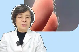手上感觉扎了刺却找不到，也很难弄出来，可能是扎到玻璃纤维了，医生教你如何处理！#科普 #生活小妙招 #健康 #扎刺 #涨知识视频封面