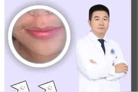 唇周长小胡子的女生，提醒你要注意自己的卵巢了#女生长胡子 #多囊卵巢综合症 #月经不规律 #抖出健康知识宝藏