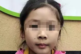 乐山寻亲：江西7岁女孩自幼被抱养，现高1米2，右脸颊有一黑痣图片