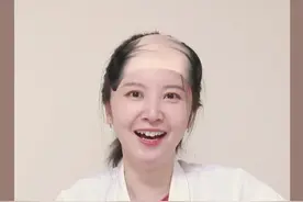 治脱发的医生自己也脱发？#医学科普 #脱发 #皮肤问题 #掉发视频封面